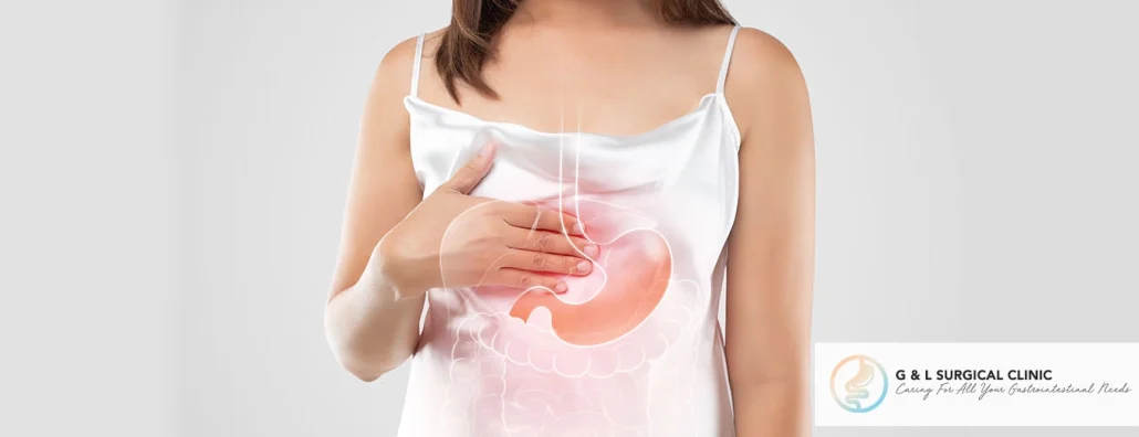 Things To Know About Anti reflux Surgery