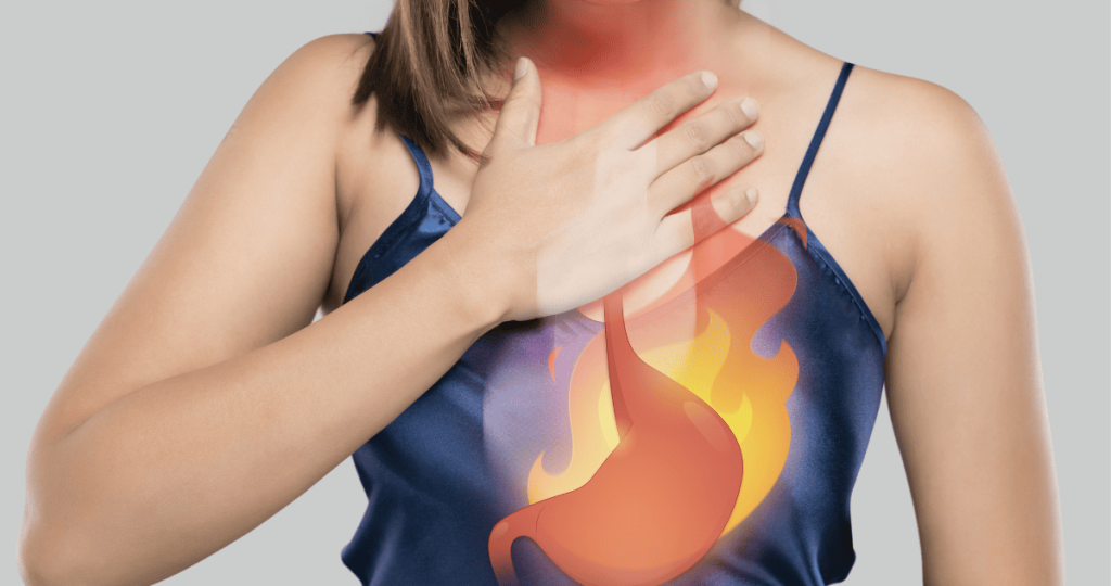 acid reflux