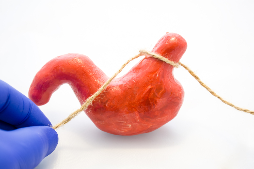 Laparoscopic BariatricMetabolic Surgery img2