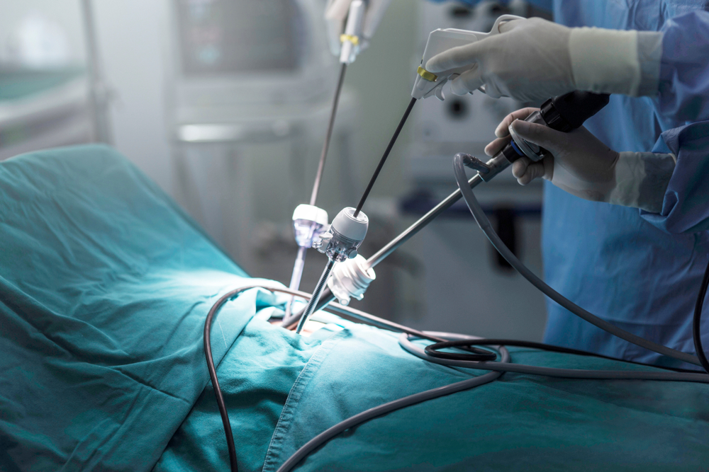 Laparoscopic Keyhole Surgery img