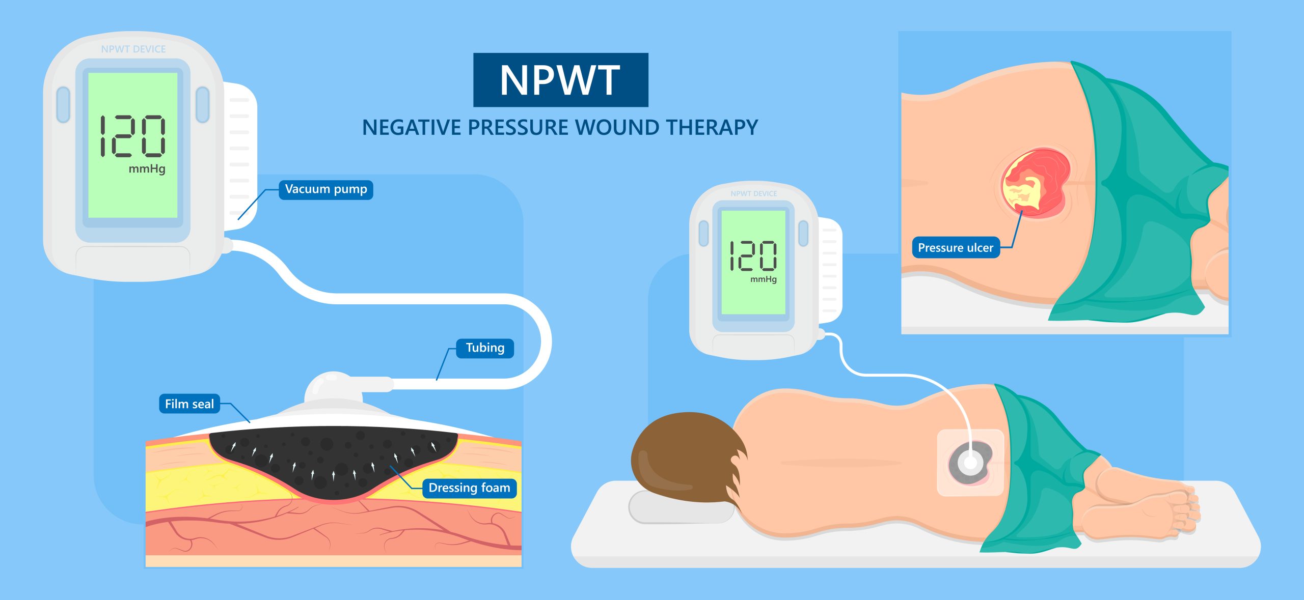 npwt img scaled