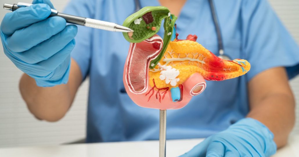anatomy mold of gallbladder